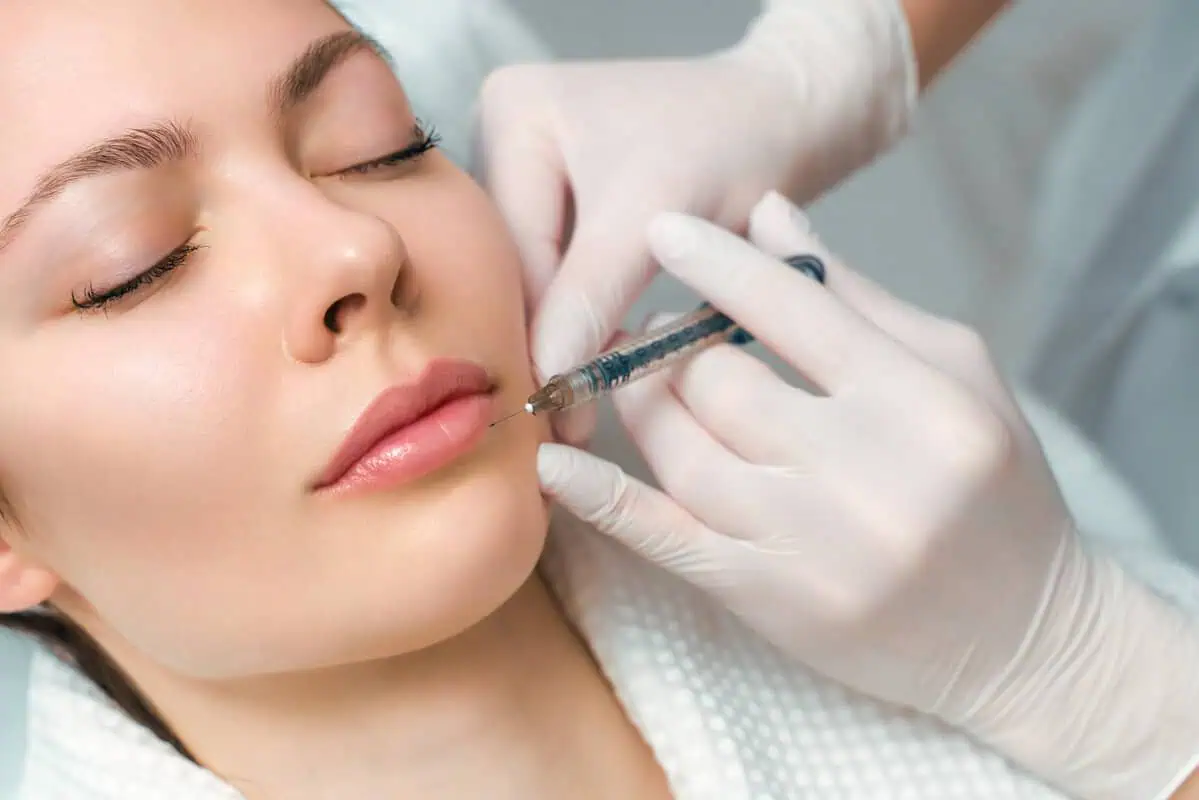 Explore the Benefits of Lip Fillers on Natural-Looking Lips by Angel Face Injections in Boston, MA