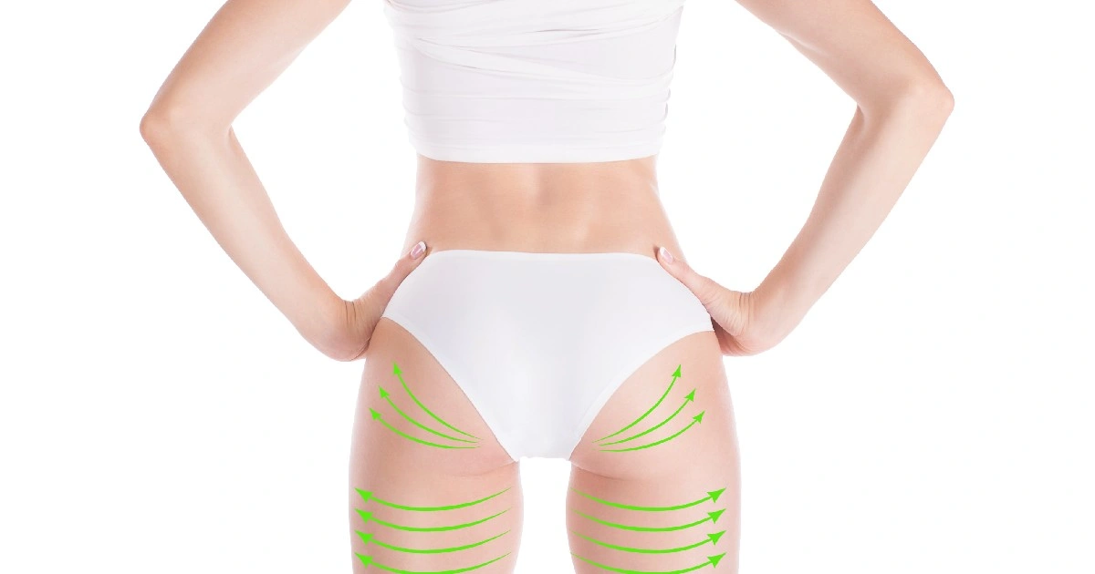 Women receiving Non-Surgical BBL in Stoneham, MA